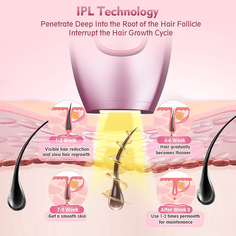 IPL laser Hair Remover Hair Cu - Industrial Laser Cutter 评论和价格
