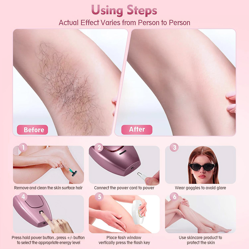 IPL laser Hair Remover Hair Cu - Industrial Laser Cutter 评论和价格